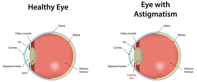 astigmastim diagram